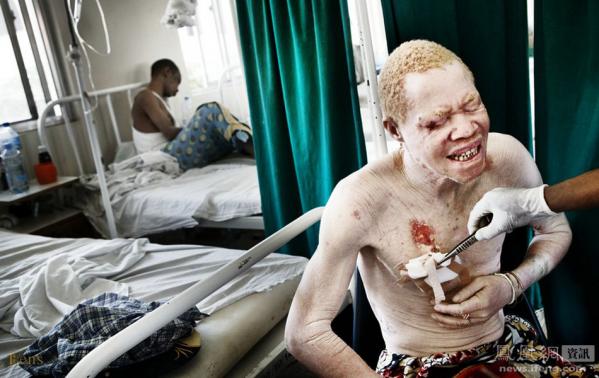 ������磺���ž�ѡ��Ƭ���㿴���磨ͼ��